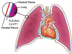 Illustration for article titled Emphysema Can Kill You Because Planes Fly
